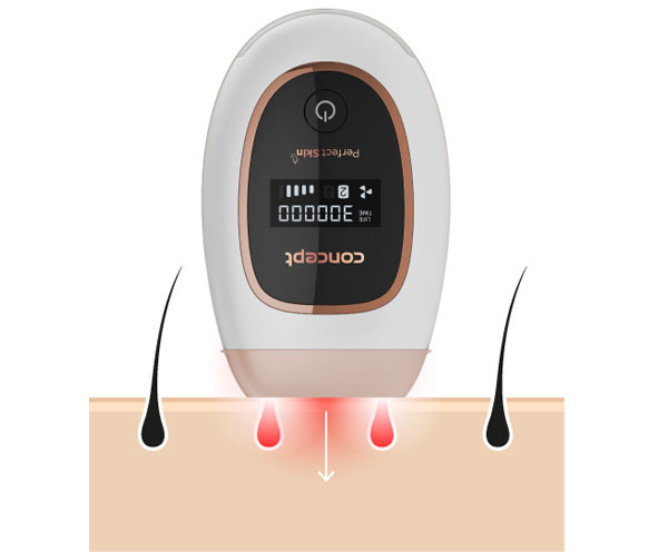 IPL technologie